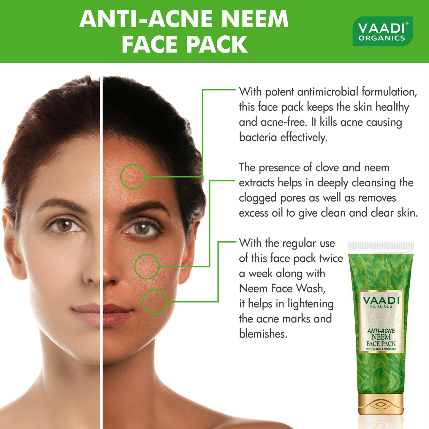 Organic Neem Face Pack with Clove & Turmeric - Removes Acne and Pigmentation Marks - Clears Impurities and Soothes Skin (120 gms / 4.3 oz) (Buy 1 Get 1 Free)