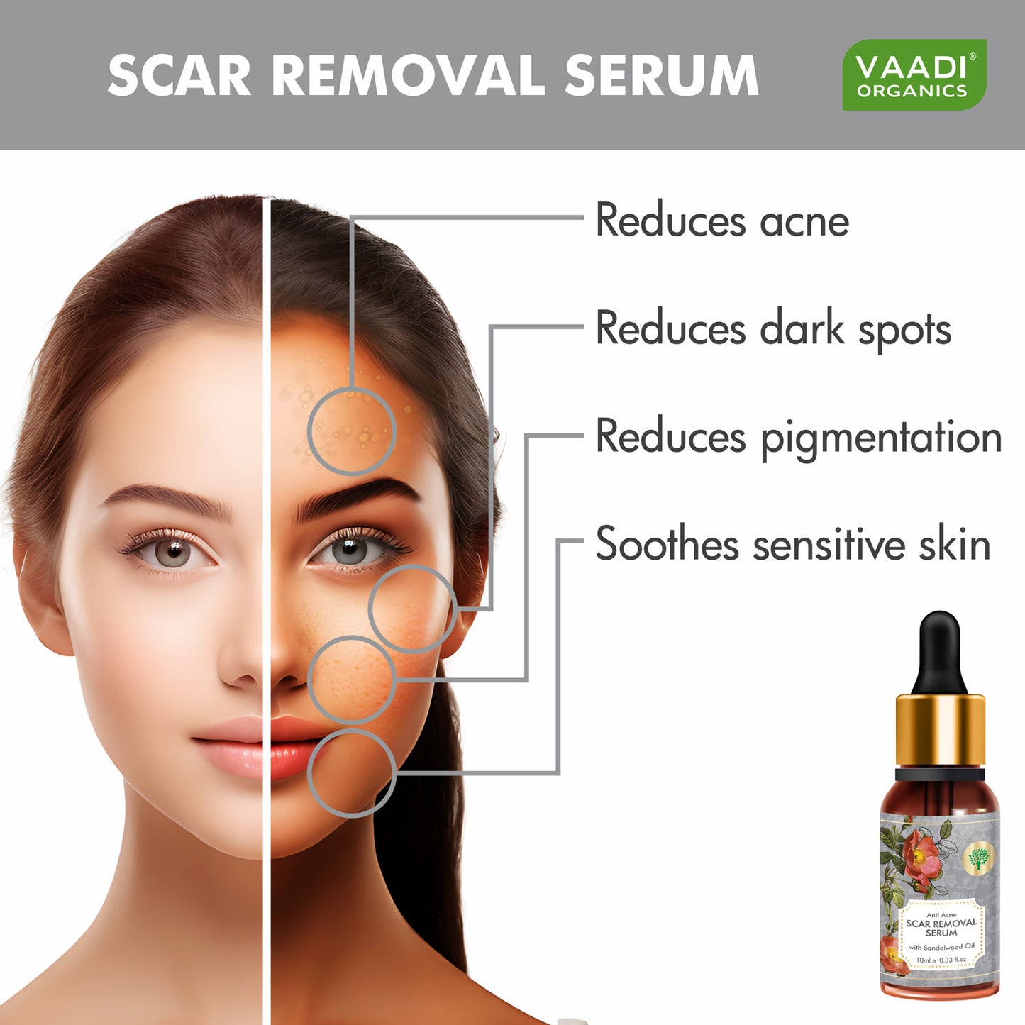 Organic Scar Removal Serum (Pure Mix of Sandalwood Oil, Steam Distilled Neem & Fenugreek Extract) - Reduces Acne, Dark Spots & Pigmentation (10 ml/ 0.33 oz)