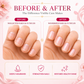 Organic Nail & Cuticle Oil with Jojoba Oil - Heals Redness & Pain - Strengthens Thin & Brittle Nails (3 x 10 ml/ 0.4 fl oz)